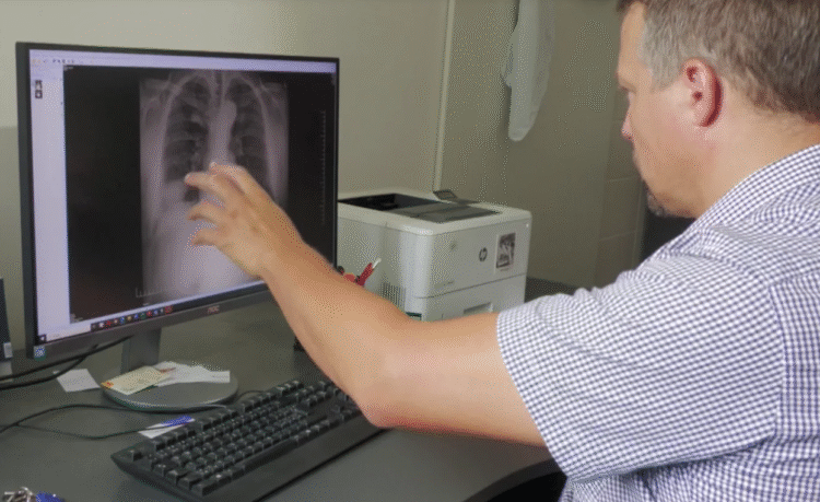 12. november, Svetový deň pneumónie – zápalu pľúc