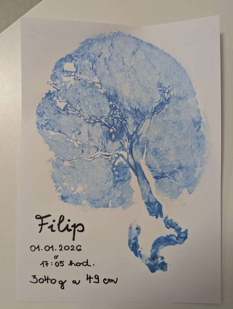 filip holub prve dieta 2026 placenta